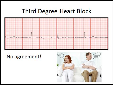 The picture above will help illustrate to you what i am talking about. Float Nurse: Heart Block Review Part II