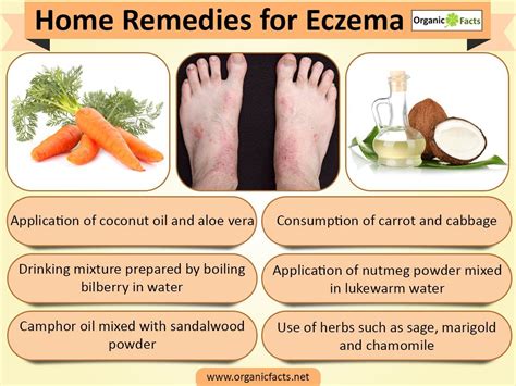There Are Quite A Number Of Effective Home Remedies For Eczema Which