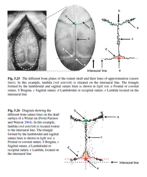 {{}}cranial suture a type of joint between the bones of the skull where the bones are held tightly together by fibrous tissue. What is the typical distance from Bregma to Lambda in ...