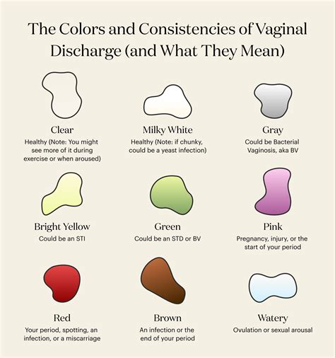 Vaginal Discharge Types Of Vaginal Discharge Vaginal Discharge The