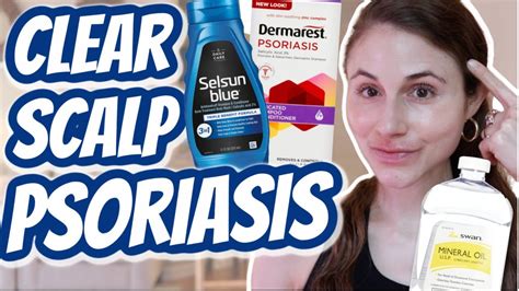 How To Clear Scalp Psoriasis Dr Dray Youtube