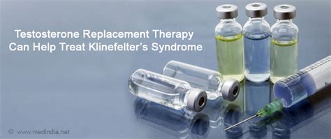 Klinefelters Syndrome Causes Symptoms Diagnosis Treatment Free