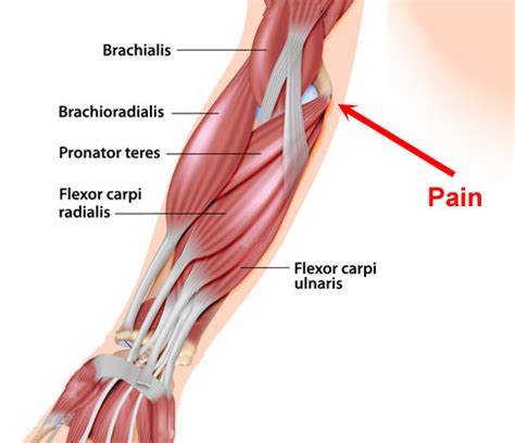 The muscles on the anterior side of the forearm, such as the flexor carpi radialis and flexor it may have two bundles of muscle with a central tendon, or it may be made up of a tendinous band. Golfer's Elbow | Symptoms, Causes and Treatment