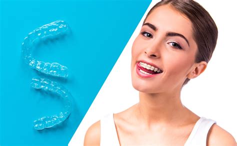 4 Types Of Clear Braces In Details Prices From £64month