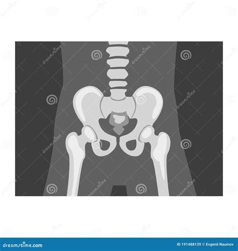 Roentgenograph Of Coxofemoral Joint Front View Vector Image
