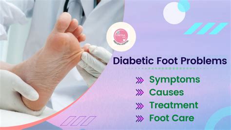 Diabetic Foot Problems Symptoms Causes Treatment And Foot Care