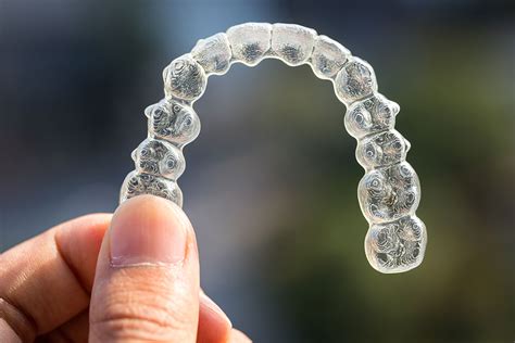 Clear Invisible Braces Invisalign Clear Braces In North York