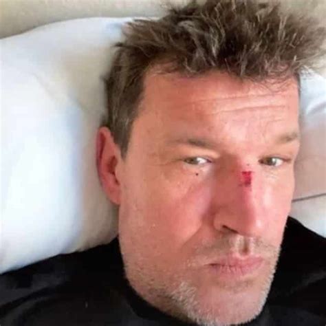 He is the former host of secret story which is a spinoff of loft story that he hosted as well. Benjamin Castaldi blessé au visage : que s'est-il passé ...