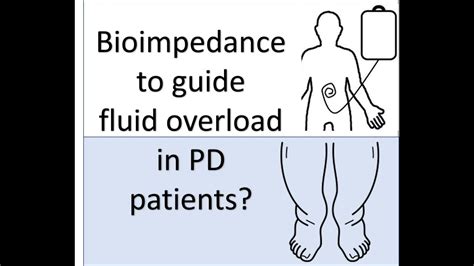 Bioimpedance Guided Fluid Management And Peritoneal Dialysis Youtube