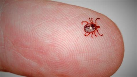 Tick Bite Leaves St Louis County Woman Allergic To Red Meat Fox 2