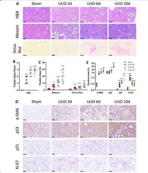 Emt And P53 P21 Mediated Cell Cycle Arrest Progresses In A