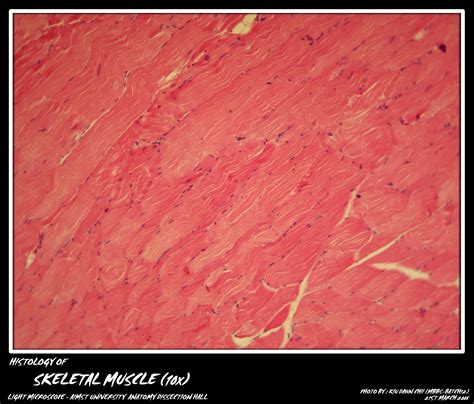 Check spelling or type a new query. Histology: Skeletal Muscle | My Aimst University Lifestyle ...