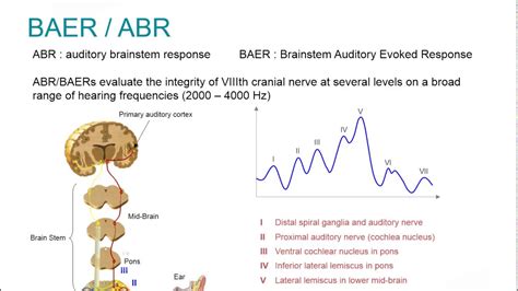 Natus Ep Webinar Clinical Auditory Evoked Potentials Youtube