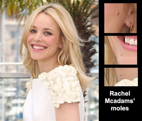 Cute Moles Beauty Marks Of Famously Beautiful Women