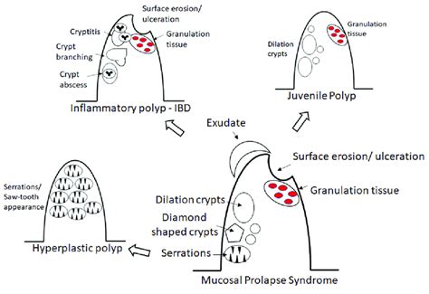 A Diagram Demonstrating The Similarity And Differences Of Mucosal