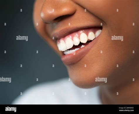 Closeup Of Woman Smiling With Prefect White Teeth Isolated Over
