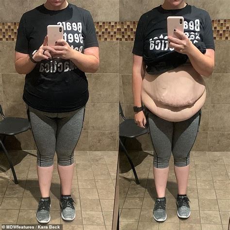 Woman Who Weighed Pounds Loses Lbs But Says Leftover Loose