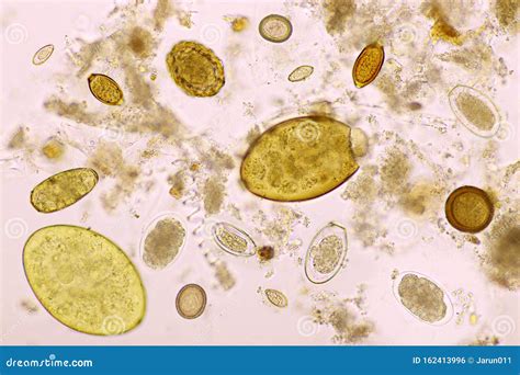 Mix Of Helminths Or Parasitic Worm In Human Stool Stock Photo Image