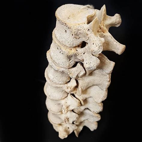 Im Putting Together A Smaller Version Of This Partial Human Spine
