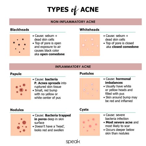 Breakup With Acne With This Breakout Guide To The Different Types Of