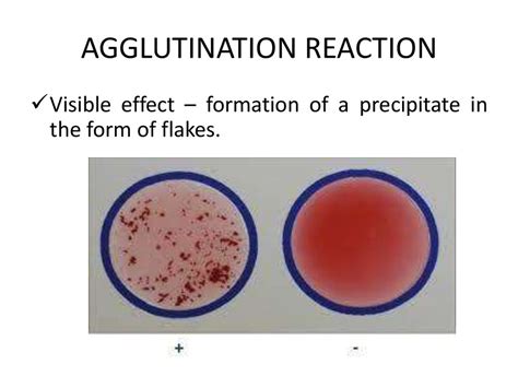 Serology Immunity Reactions Agglutination Precipitation And