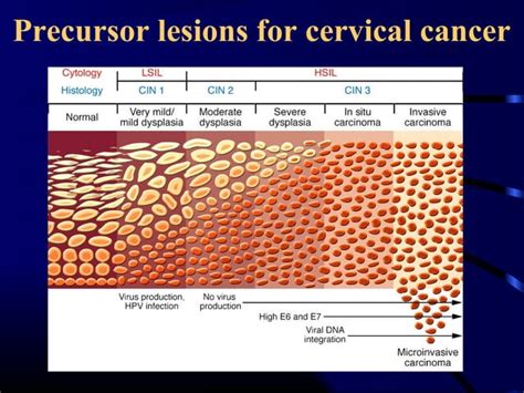 Cinandcancer Cervix Undergraduate