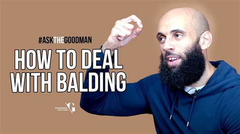 How To Deal With Balding Part 2 I Went Bald At 21askthegoodman Youtube