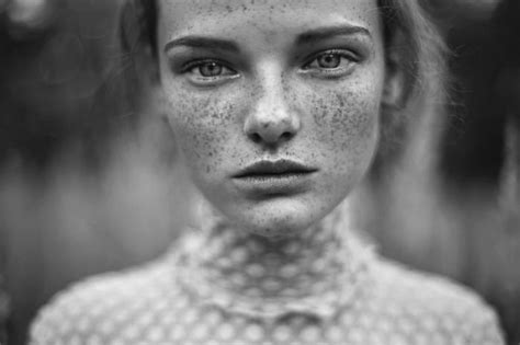 15 Freckled People Wholl Hypnotize You With Their Unique