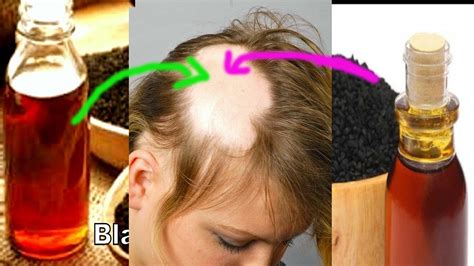 What it is composed of, health benefits, possible side spoiler alert! How To Use Kalonji Black Seed Oil For Hair Growth And ...