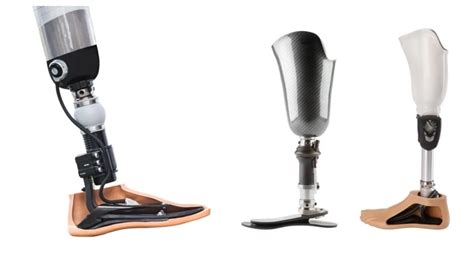 What Is Prosthetic Leg And Orthosis What Are The Types Orthopedics