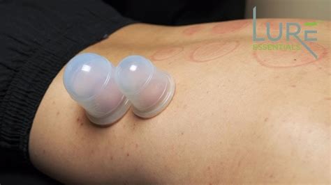 Cupping Therapy Set Zen By Lure Essentials Benefits Of Cupping And How To Diy Cupping At Home