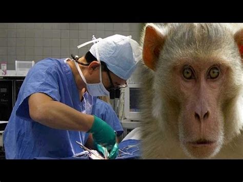 Monkey Head Transplant Done First Time In History Surgeon Claims