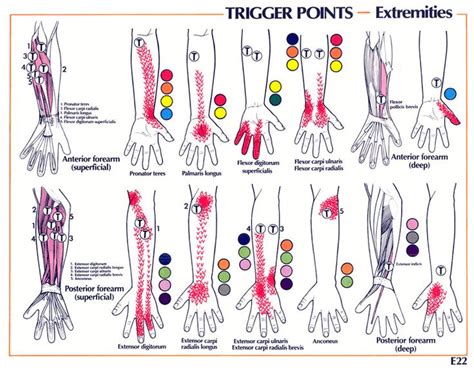 Pin On Trigger Points
