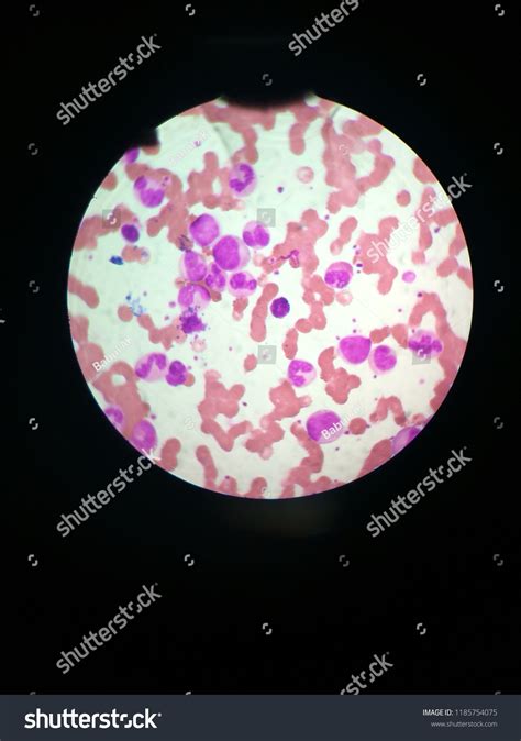 Monocytes Lymphocytes Human Blood Smear Stock Photo 1185754075