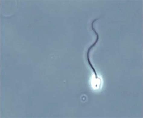 Why These Sperm Are The Key To The Future Of Fertility And Contraception