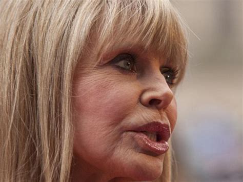 Chatter Busy Britt Ekland Plastic Surgery