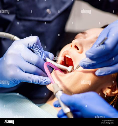 Männliche Zahnarzt Zähne Behandeln Zu Junge Frau Die Patienten In Der