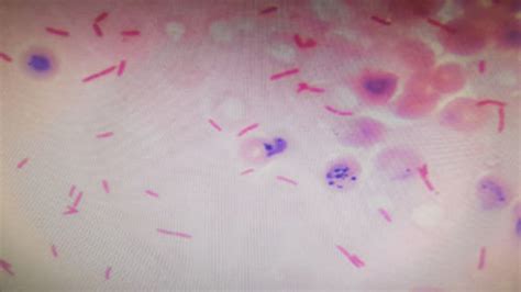 Gram Negative Rods In Palisade In Smear From Blood Culture