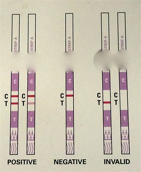 Strep is a common but serious bacteria. Quest for Health: Recurrent Strep Throat