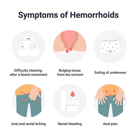 Hemorrhoids And What To Do About Them Gi Associates