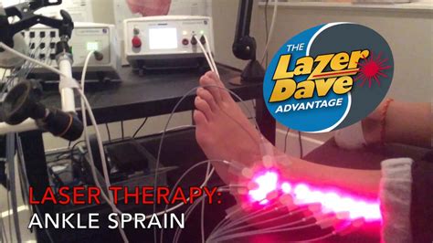 Ottawa Laser Therapy For Ankle Sprains With Lazer Dave Certified Laser