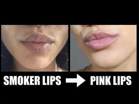 Dark Smoker Lips Get Pink Lips Fast Smokers Skin Lip Lightening