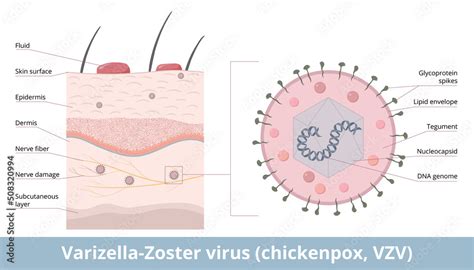 Varicella Zoster Virus Chickenpox Vzv Detailed Scheme Of Varizella Zoster Virion Including