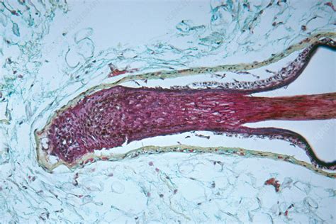 Human Hair Follicle Lm Stock Image C0176042 Science Photo Library