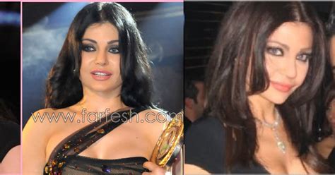 Haifa Wehbe Plastic Surgery Before And After Facelift And Browlift