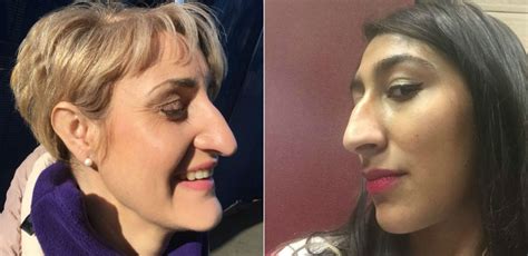 sidenoseselfie people are proudly breaking down barriers with their big noses
