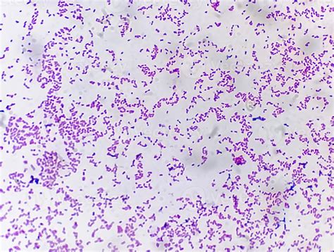 Bactéria Escherichia Coli Li Bactérias Gram Negativas Em Forma De