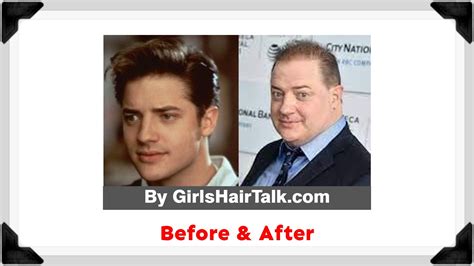 Brendan Fraser Hair Loss Is He Balding What Happened