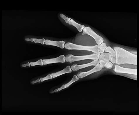 Facts You May Not Have Known About X Rays Seton Imaging