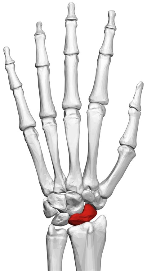 Scaphoid Fracture The Lothian Hand Unit